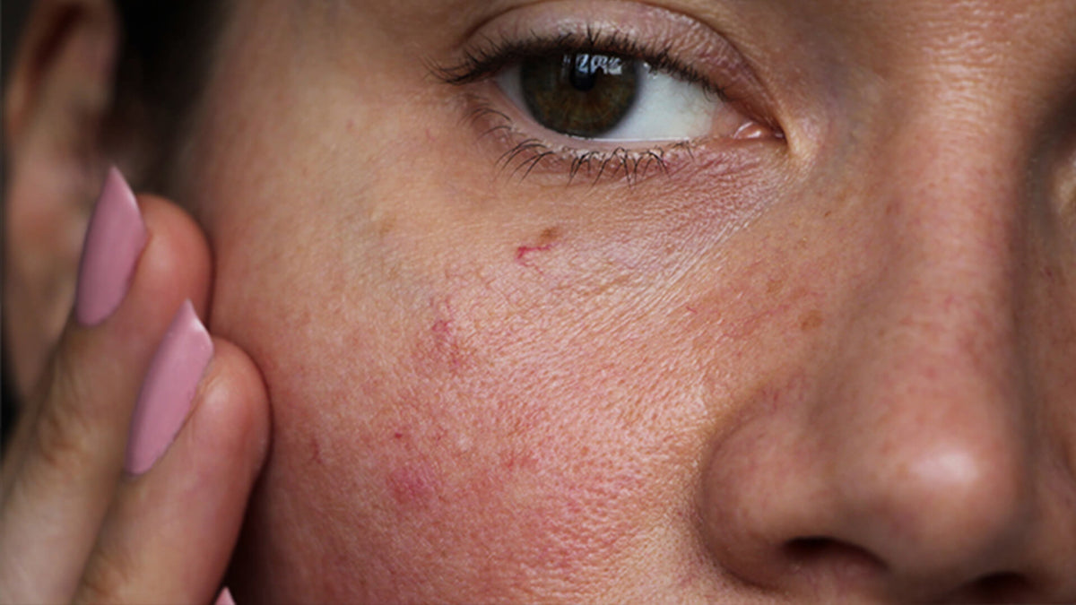 beauty devices and skincare
